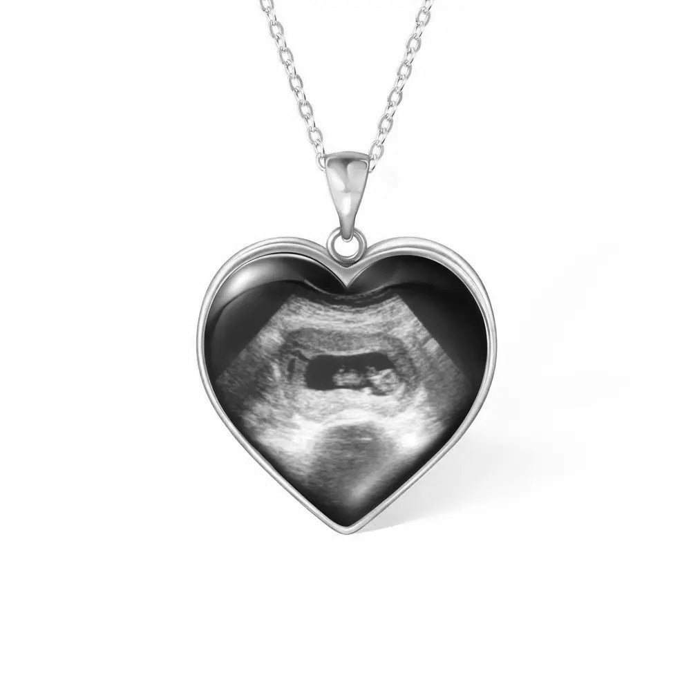 Baby Remembrance Necklace with Heart Shaped Ultrasound Image - United Bracelets